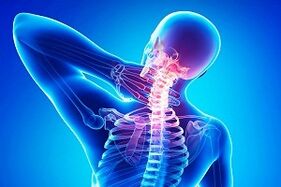 Osteokondroz belirtisi olarak sırt ağrısı