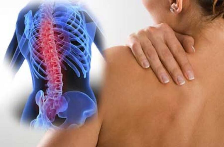 Torasik omurganın osteokondrozunun alevlenmesi ile dorsago ağrısı oluşur