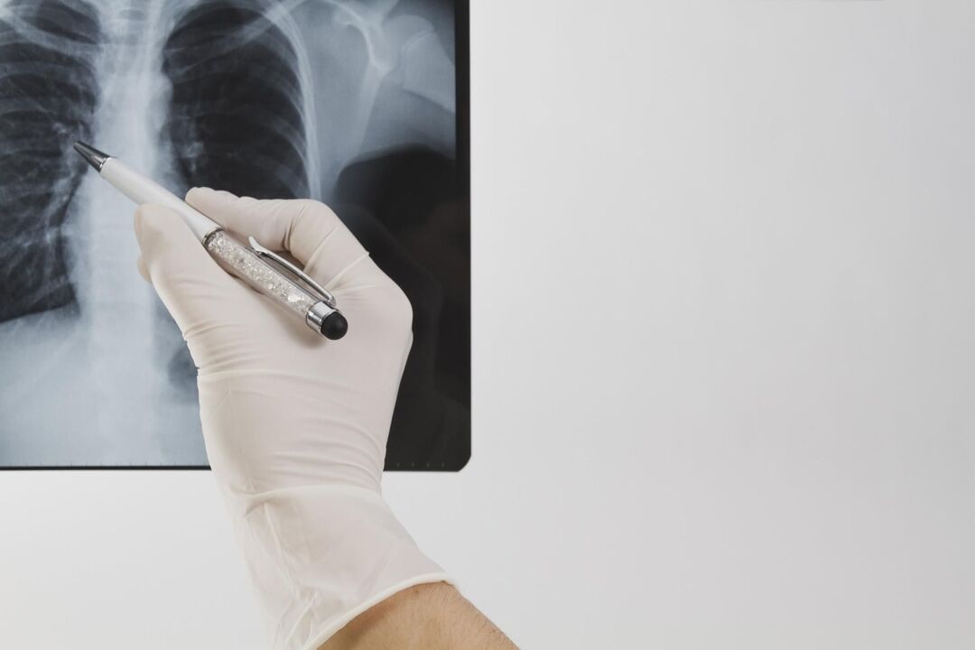 Osteokondrozu teşhis etmek için röntgen