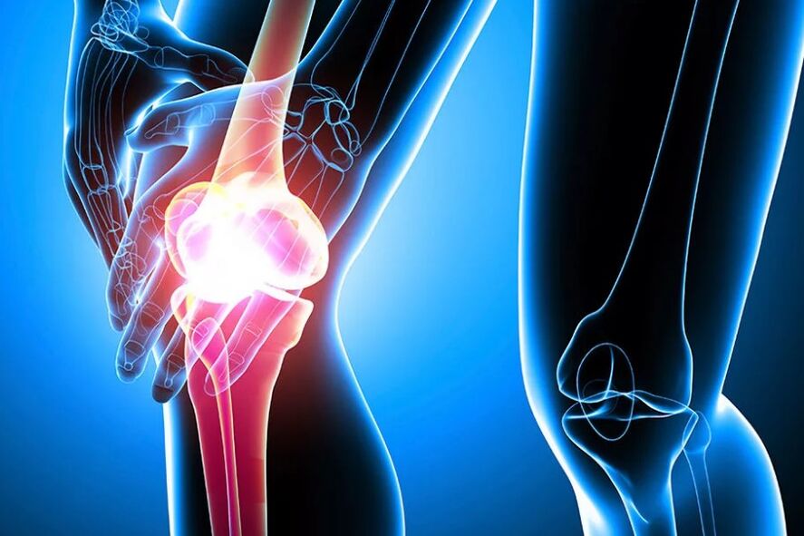 Diz osteoartriti
