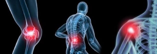 Osteoartrit ile ağrı tipleri