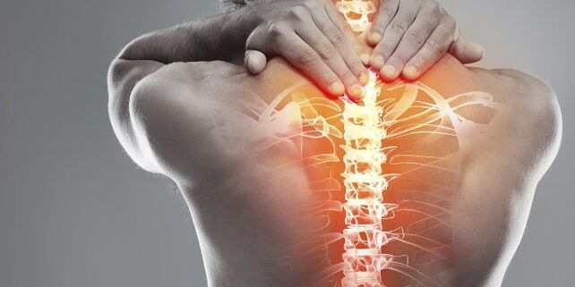 Servikal osteokondrozun serviks tedavisi için tıbbi seçenekler