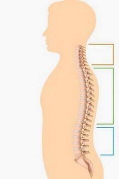 Omurganın farklı kısımlarının osteokondrozunun lezyonu