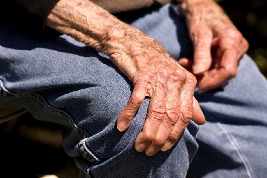 Osteoartrit yaşlı insanlarda ortaya çıkan yaşa bağlı bir hastalıktır