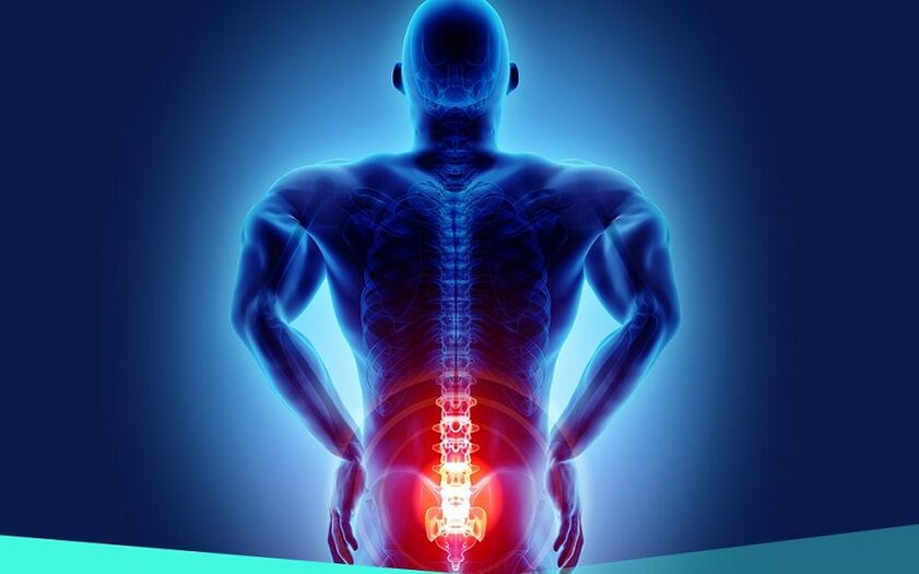 Kalça osteoartritine bağlı ağrı