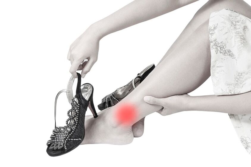 Osteoartrit nedeniyle ayak bileği ağrısı